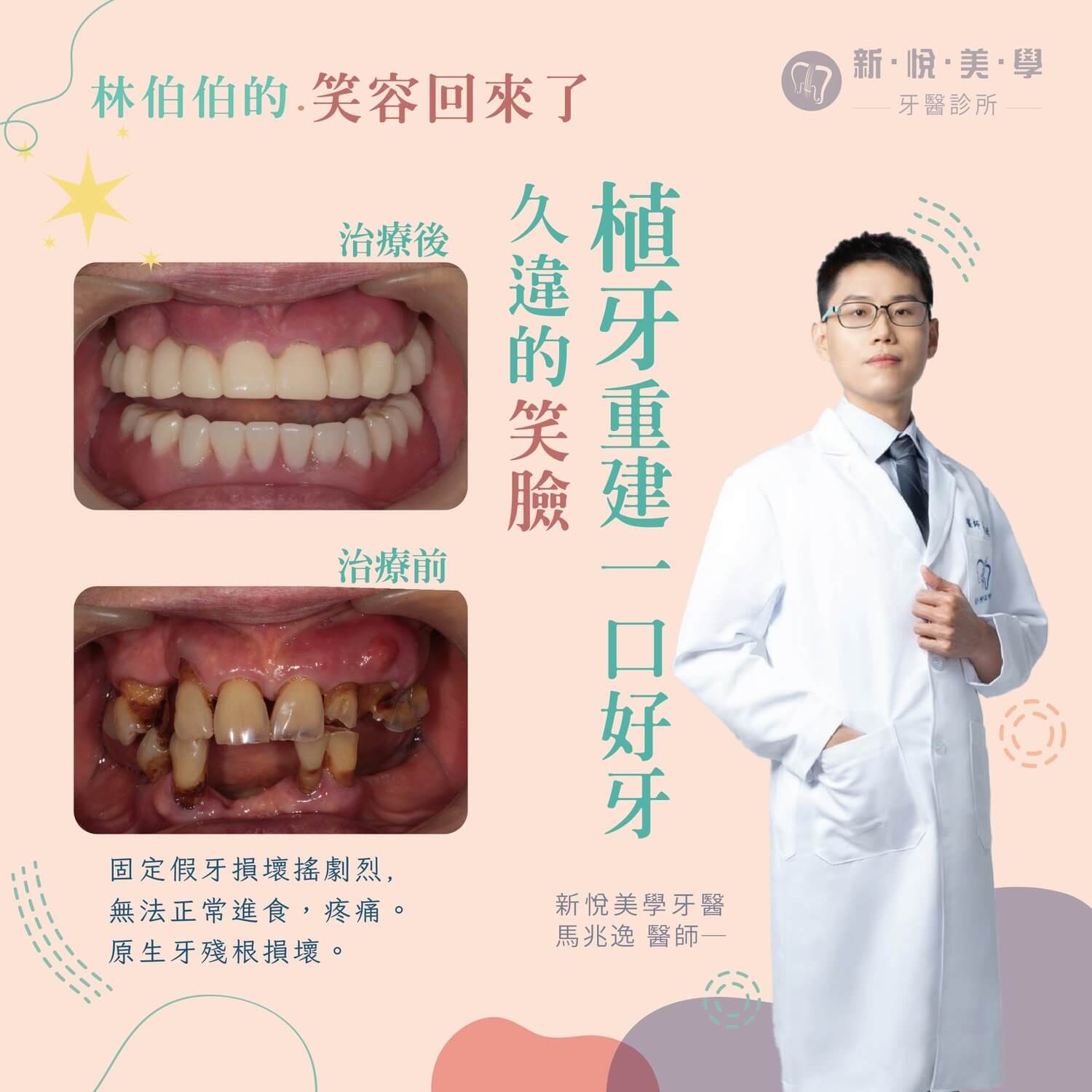 新悅美學牙醫診所的案例分享圖片
